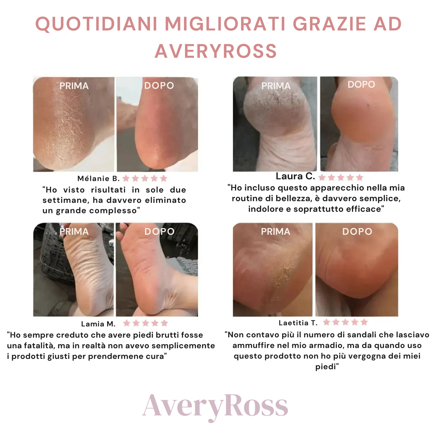 AveryRossâ„¢ - Il tuo kit bellezza piedi di lusso